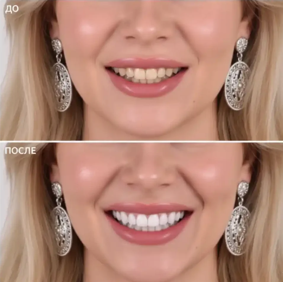 Generated Image April 15, 2026 - 11_13PM